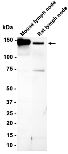 Recombinant CD103 Monoclonal Antibody (AGEL6389)