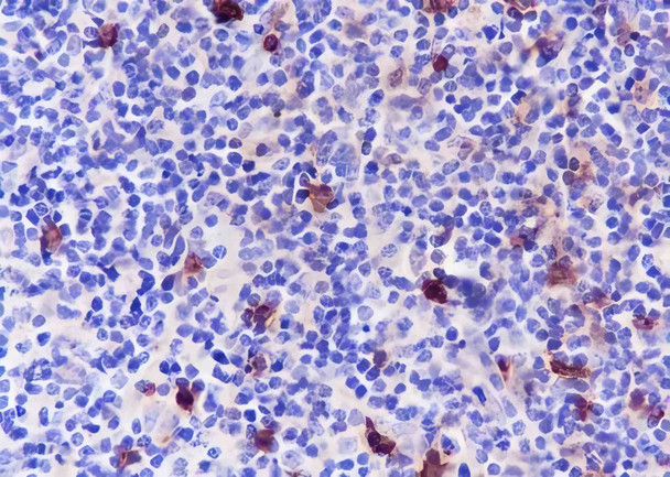 Recombinant CD134/OX40 Monoclonal Antibody (AGEL6391)