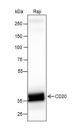 Recombinant CD20 Monoclonal Antibody (AGEL6399)
