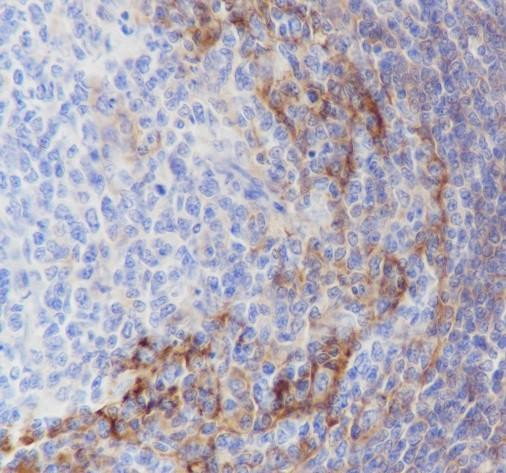 Recombinant CD23 Monoclonal Antibody (AGEL6400)