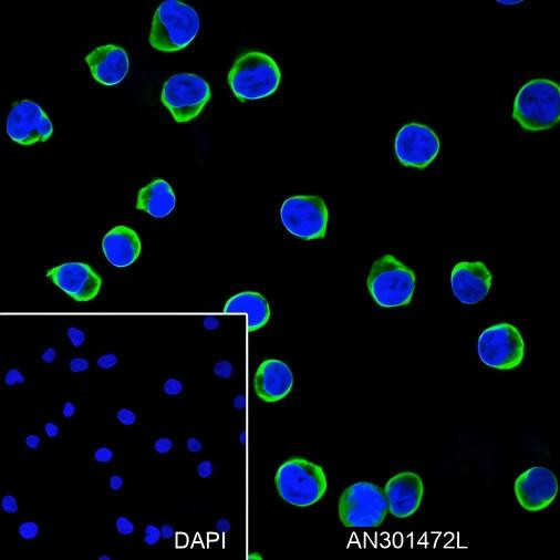 Recombinant CD25 Monoclonal Antibody (AGEL6401)