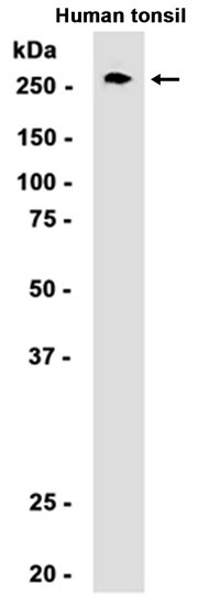 Recombinant CD35 Monoclonal Antibody (AGEL6405)