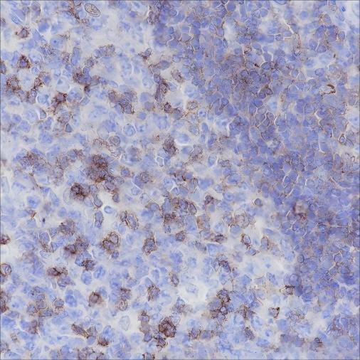 Recombinant CD50/ICAM3 Monoclonal Antibody (AGEL6410)