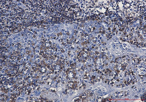 Recombinant CD79a Monoclonal Antibody (AGEL6415)