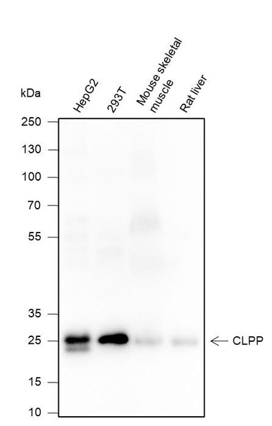 Recombinant CLPP Monoclonal Antibody (AGEL6425)