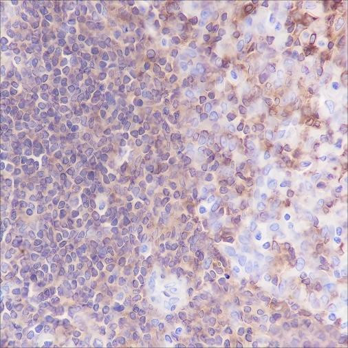 Recombinant CSF-1R Monoclonal Antibody (AGEL6429)