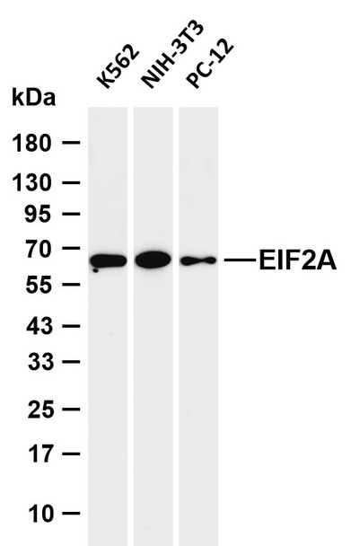 Recombinant EIF2S1 Monoclonal Antibody (AGEL6441)