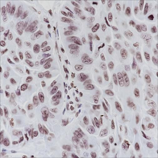 Recombinant ERCC1 Monoclonal Antibody (AGEL6446)