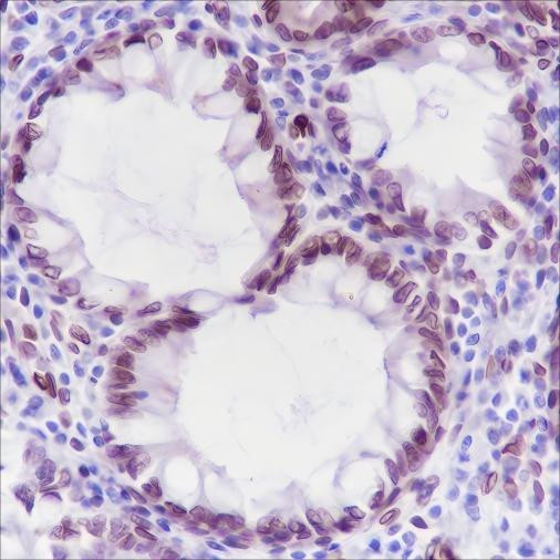 Recombinant FBXW7 Monoclonal Antibody (AGEL6450)