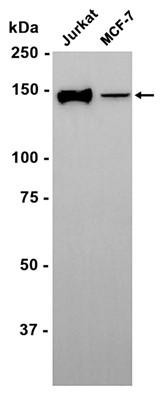 Recombinant FGFR2 Monoclonal Antibody (AGEL6451)