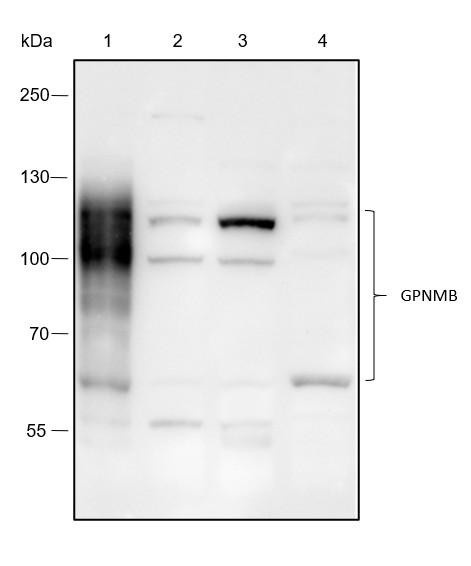 Recombinant GPNMB Monoclonal Antibody (AGEL6469)