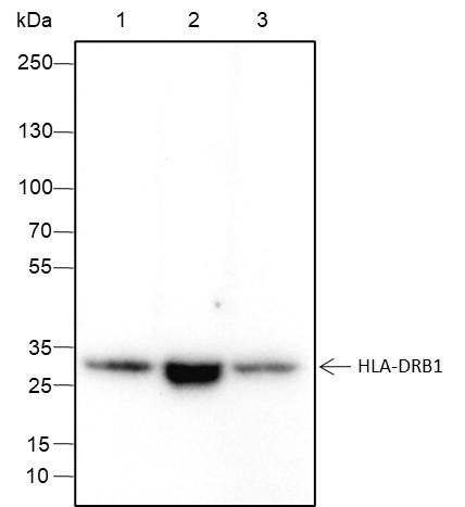 Recombinant HLA-DRB1 Monoclonal Antibody (AGEL6482)