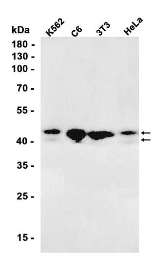 Recombinant JunB Monoclonal Antibody (AGEL6498)