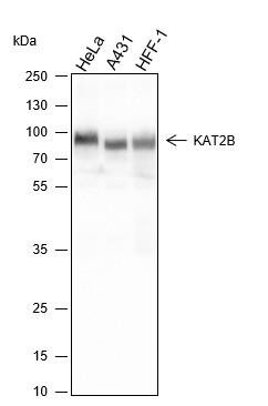 Recombinant PCAF Monoclonal Antibody (AGEL6500)