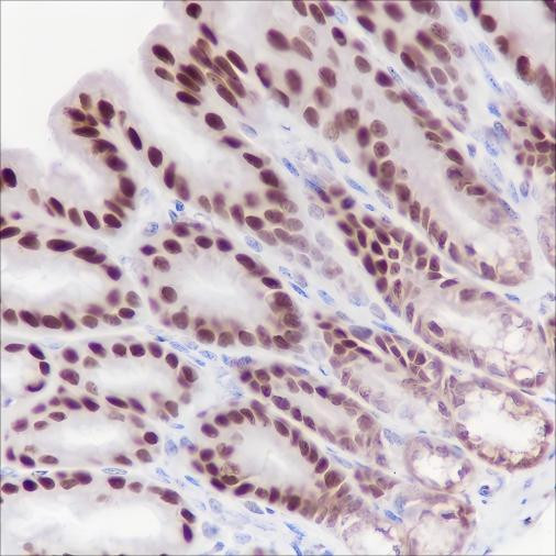 Recombinant Ku80 Monoclonal Antibody (AGEL6512)