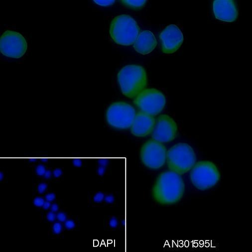 Recombinant MALT1/MLT Monoclonal Antibody (AGEL6523)