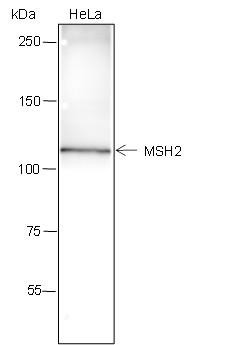 Recombinant MSH2 Monoclonal Antibody (AGEL6532)
