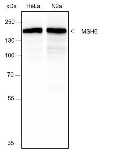 Recombinant MSH6 Monoclonal Antibody (AGEL6533)