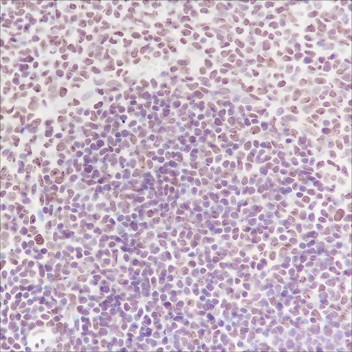 Recombinant NPM1 Monoclonal Antibody (AGEL6540)
