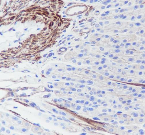 Recombinant Pan-Actin Monoclonal Antibody (AGEL6546)