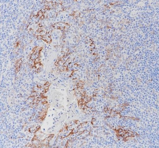Recombinant PD-L1 Monoclonal Antibody (AGEL6551)