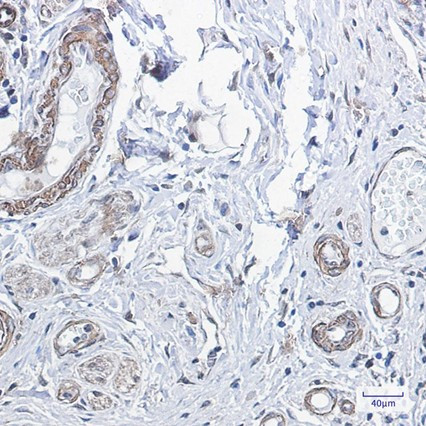 Recombinant PPP1CB Monoclonal Antibody (AGEL6562)