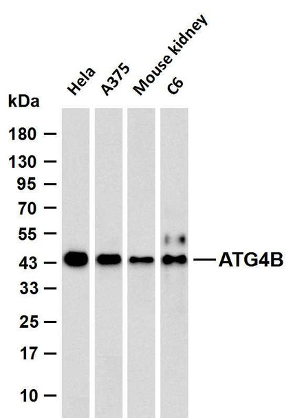 Recombinant ATG4B Monoclonal Antibody (AGEL6568)