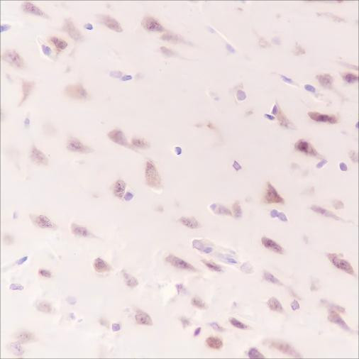 Recombinant WWOX Monoclonal Antibody (AGEL6617)