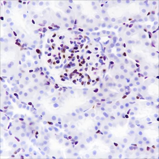 Recombinant ERG Monoclonal Antibody (AGEL6642)