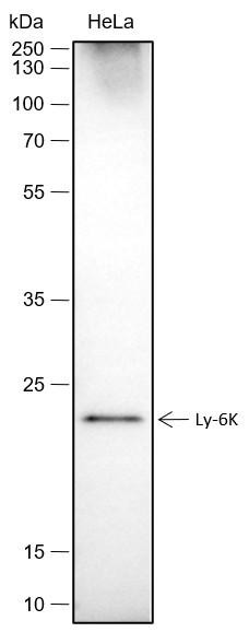 Recombinant Ly-6K Monoclonal Antibody (AGEL6643)
