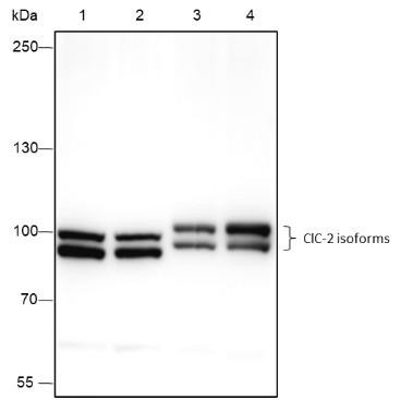 Recombinant ClC-2 Monoclonal Antibody (AGEL6649)