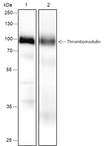 Recombinant Thrombomodulin Monoclonal Antibody (AGEL6667)
