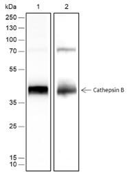 Recombinant Cathepsin B Monoclonal Antibody (AGEL6683)