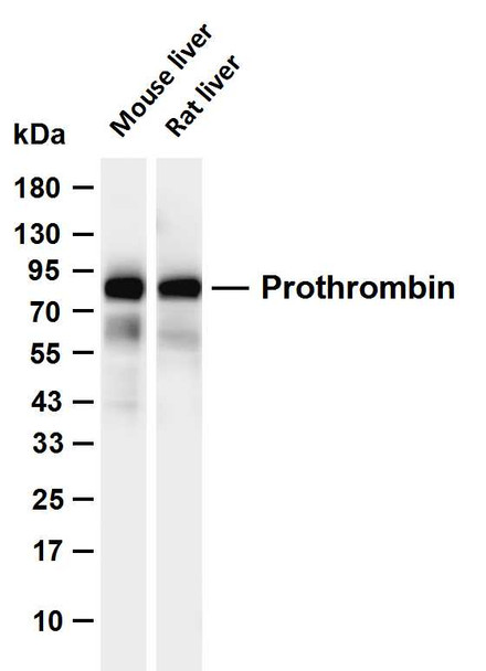 Recombinant Prothrombin Monoclonal Antibody (AGEL6714)