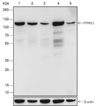Recombinant PTPN12 Monoclonal Antibody (AGEL6717)