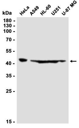 Recombinant ING1 Monoclonal Antibody (AGEL6745)