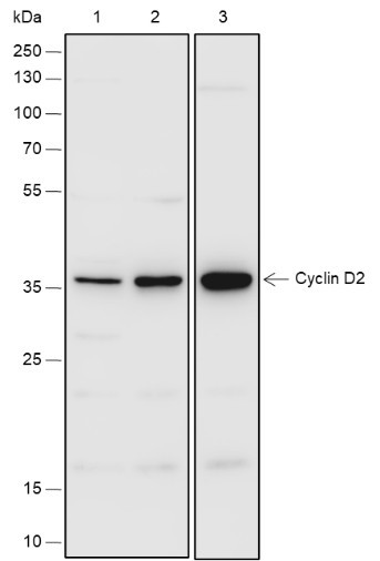 Recombinant Cyclin D2 Monoclonal Antibody (AGEL6757)