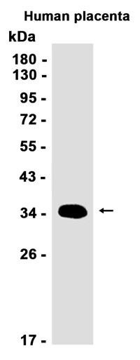Recombinant HSD17B1 Monoclonal Antibody (AGEL6773)