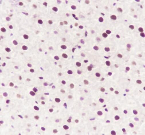 Recombinant ATF1 Monoclonal Antibody (AGEL6777)