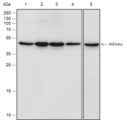 Recombinant IKB beta Monoclonal Antibody (AGEL6778)