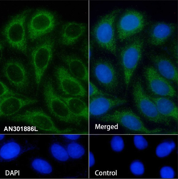 Recombinant SHIP-1 Monoclonal Antibody (AGEL6812)
