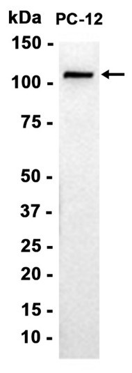 Recombinant KIF5B Monoclonal Antibody (AGEL6815)
