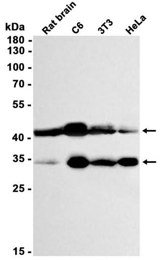 Recombinant MBD2 Monoclonal Antibody (AGEL6831)