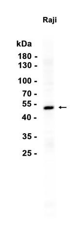 Recombinant DDB2 Monoclonal Antibody (AGEL6846)
