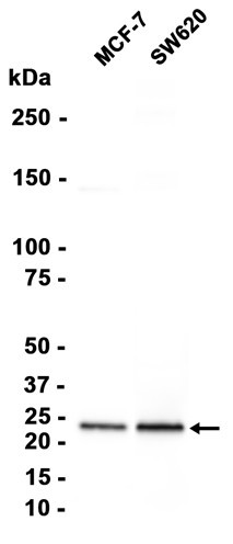 Recombinant Rab8A Monoclonal Antibody (AGEL6849)
