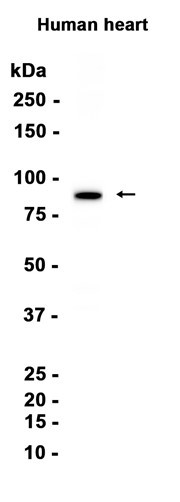 Recombinant CPT1B Monoclonal Antibody (AGEL6882)