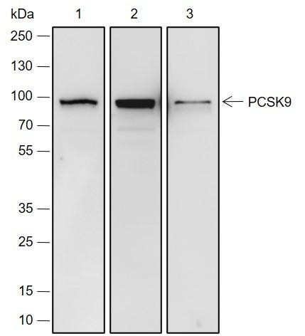 Recombinant PCSK9 Monoclonal Antibody (AGEL6884)