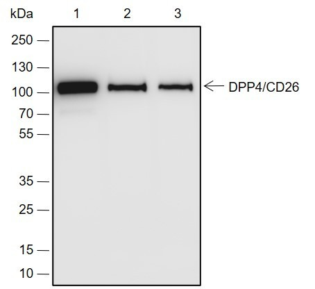 Recombinant DPP4/CD26 Monoclonal Antibody (AGEL6890)