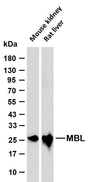 Recombinant MBL2 Monoclonal Antibody (AGEL6904)