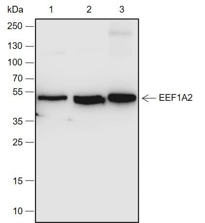 Recombinant eEF1A2 Monoclonal Antibody (AGEL6905)